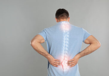 Can I Exercise If I Have Scoliosis?